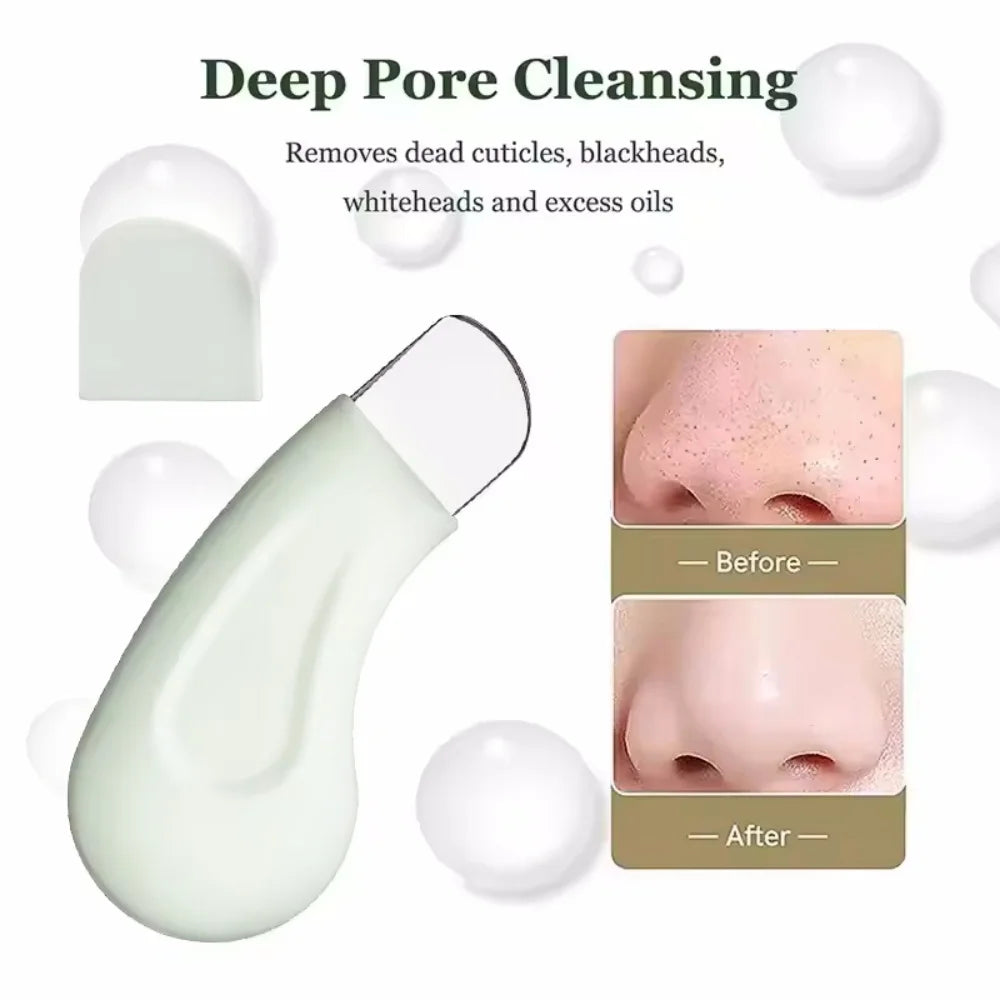 Facial Blackhead Removal Tool